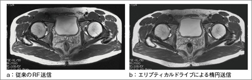 }4@GveBJhCuɂʁFՏ摜