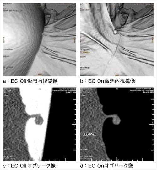 }2@Electronic CleansingiECj@\