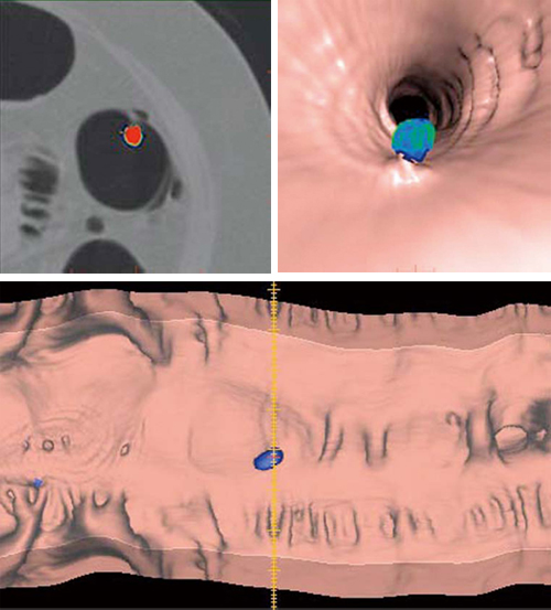 }3@VCARiVolume Computer Assisted Readingj@\