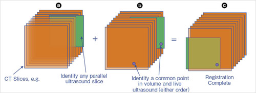 }3@2_eBԂ̈ʒu킹̊TO