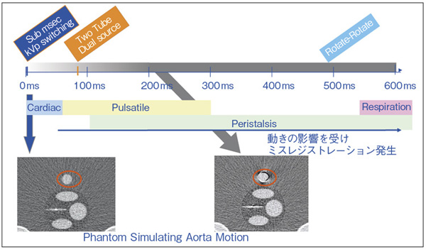 }1@Dual Energyԕ\̍ɂ摜ւ̉e