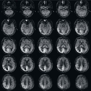 }5@3D ASLiCBF}bsOjɂ]^ᇂ̉摜