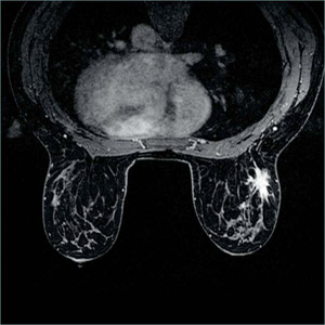 }8@VIBBRANT-FLEX̉摜