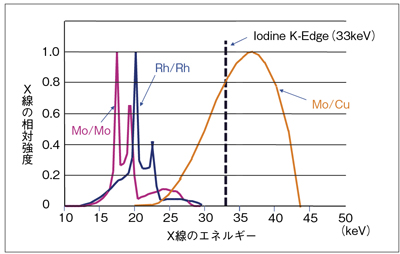 新機能 Senobright を支える製品技術 技術解説 Geヘルスケア ジャパン株式会社 Innavi Suite