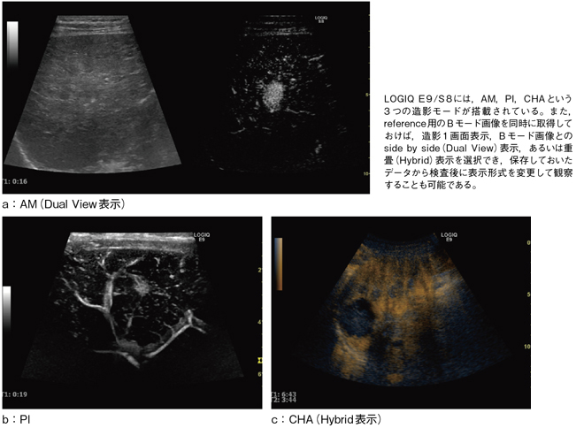 }1@LOGIQɓڂĂ鑢e[h