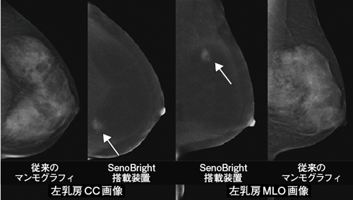 }2@]̃}OtBSenoBrightڑu̎Be摜 AWAɑƌBx̍[̏ǗB]̃}OtB摜ł͓BɏdȂĂaϕSenoBrightڑuł͖Ăɕ`oB i摜񋟁FO͓NjbN@EJO_搶j