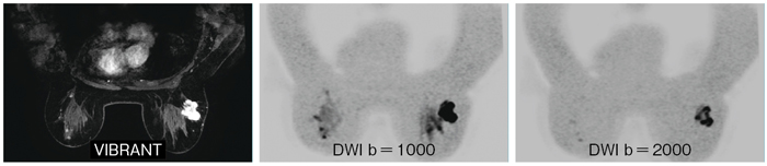 }1@GE MRI̓B{[AvP[Vi摜񋟁FHەa@lj