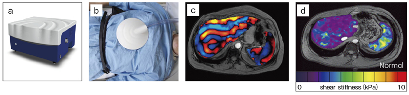 図8 MRエラストグラフィ(MRE)において使用するデバイスと出力データ