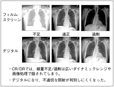 図1 線量の過不足例