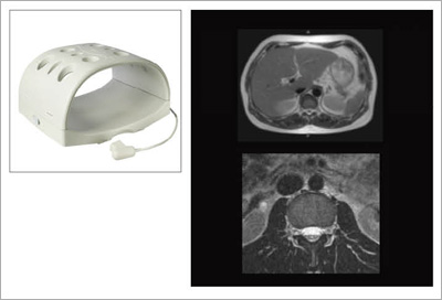 }7@RAPID BodyRCƉ摜