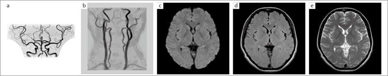 Ǘ1F16ch RAPID Head attachment NVRCgpMRI/MRAij