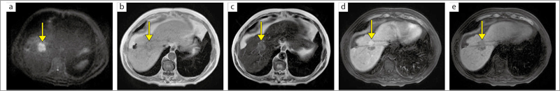 Ǘ2FTAEi̓ǐÖ@jCRFAiWIgĎܗÖ@j{s̎caρi̍זEj