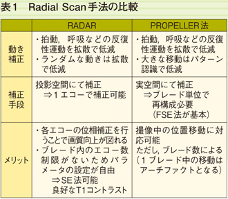 \1@Radial Scan@̔r