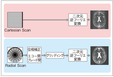 }1@Cartesian ScanRadial Scanɂ摜č\@