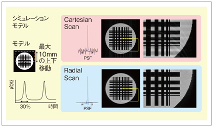 242 プレーンアーチ法 日本人に適したスライディングメカニクスの理論と臨床 242 プレーンアーチ法 日本人に適したスライディングメカニクス