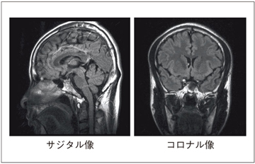 }4@RADAR̎BfʗiRADAR-FLAIRj