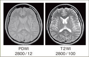 }7@Dual Contrast RADAR-FSE