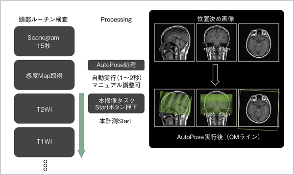 }5@Bʒuݒ uAutoPosev