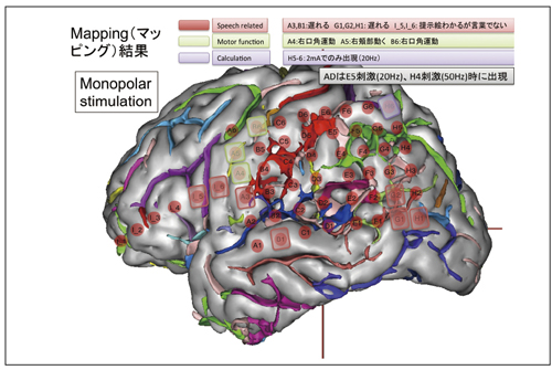 }4@pO̔]@\}bsO摜 E߂ԊoCvZEƂ̋@\tɎᇂǗB܂T1摜Ƃɔ]\ʂ̂̏Ȃǂ𓾂Ĕ]̎O摜쐬C]ɓdɂ𖄂ߍŁCcC炪3TԂĔ]@\́C}bsOsB