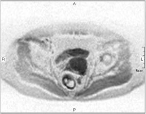 cFH-sincpDWIib50s/mm2j