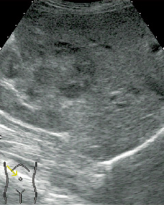 bFLowMIłFundamental