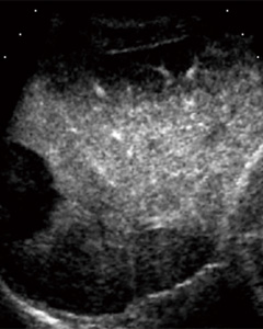 aFĎ܌US contrast io[`j