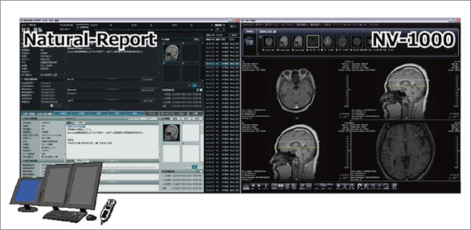 }1@NV-1000Natural Reportgݍ킹ǉe