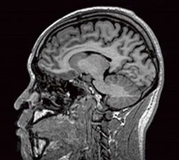 }2@3D-GEIR摜iTR/TE/FA/TI9.2/4.0/8/1000j