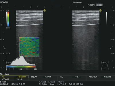 }3@Strain Histogramv