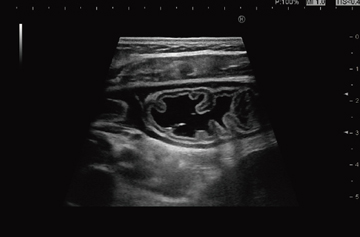 }1@HI REZiHigh Resolution Imagingj