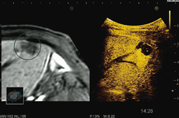 }3@Contrast Harmonic Imaging{RVSi񋟁FȑwȁE XjT搶j