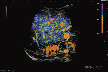 }4@Inflow Time Mappingi񋟁FȑwȁE XjT搶j