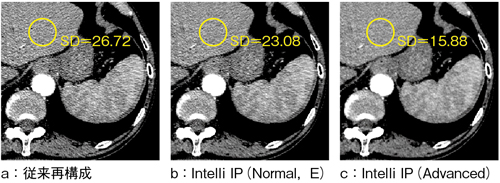 }5@Intelli IPKp摜iCWW200CWL60j