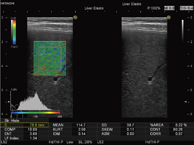 }3@Strain Histogramv\tgɂ摜