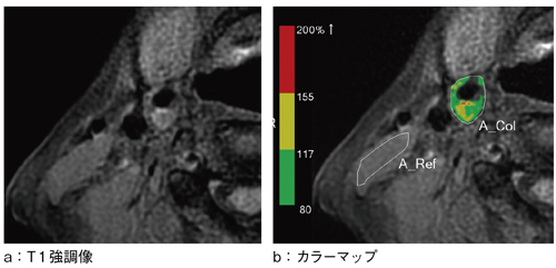 図3 カラーマップ作成ツールを用いたプラーク解析