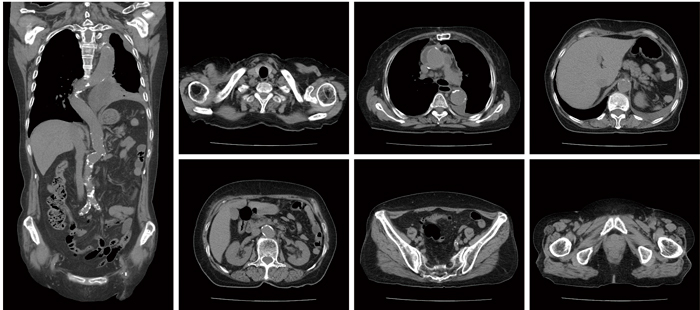 図6 180mm/s(0.35s/rot, BP=1.58)で700mmを3.8sで撮影