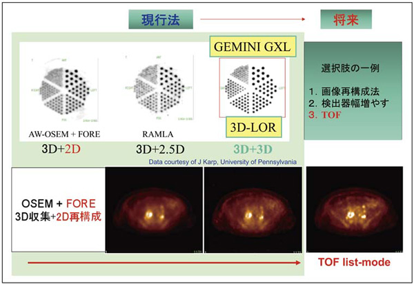 }6@tBbvXPET/CTɂ摜̈Ⴂ