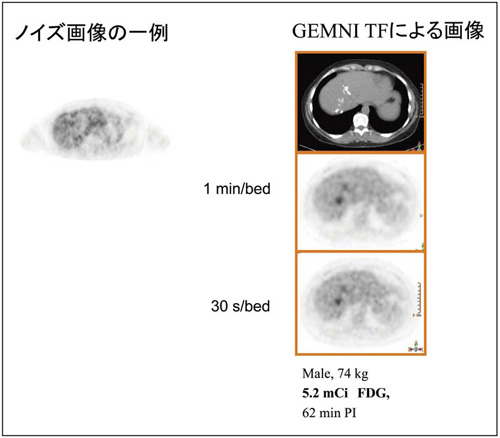 }7@GEMINI TF̉摜iImages Courtesy of Saint-Luc Hospital, Brusselsj