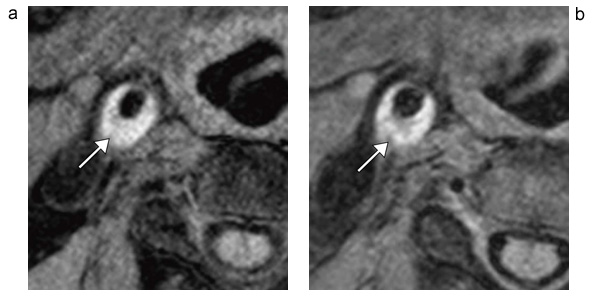 }2@򓮖v[NɂDIR@MSDE@̔r