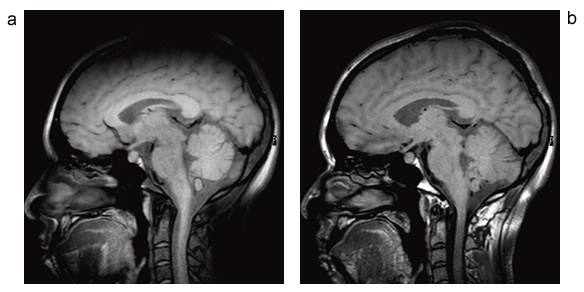 }5@MSDE@iMSDE@ŎB摜