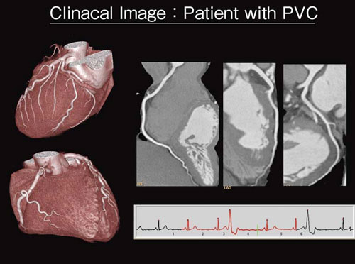 }2@BrillianceiCT Clinical image