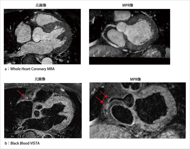 }4@Black Blood VISTA