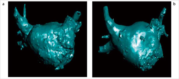 }6@3D-ATGɂ鍶S[̕`oiajCTXLiɂ鍶S[̕`oibj