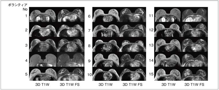 }2@MultiTransmitŎBꂽ15̓B̃{eBA摜