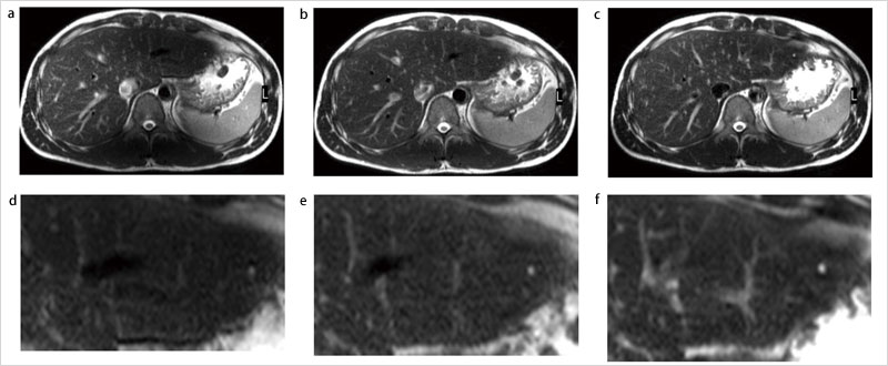 }5@MultiTransmitƏ]M@ɂ摜RgXg̔r