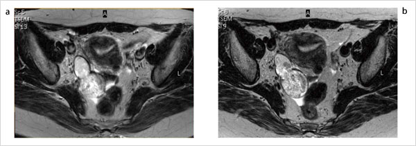 }6@MultiTransmitpԕ\摜