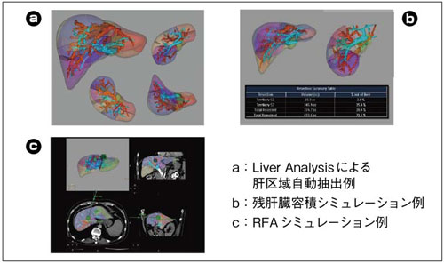 }4@Liver Analysisɂ摜͗