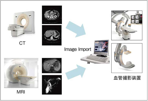 }4@CTMRI̐ff摜ǎBeuɓ