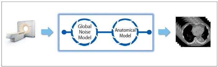 図2 iDose4の概念図