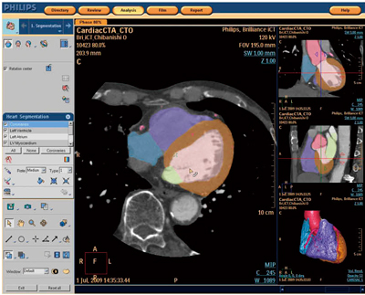 図4 Comprehensive Cardiac Analysis(C.C.A.)